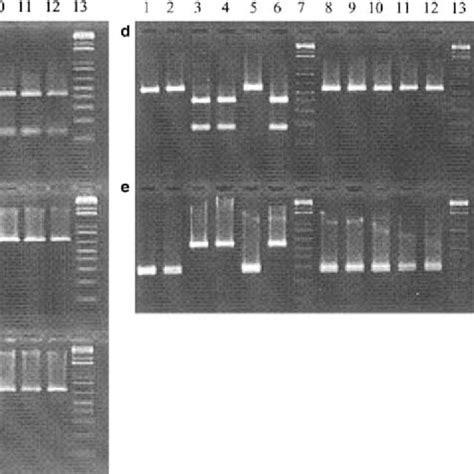 Pcr Rflp Analysis Of The Coi Gene And Its Region Pcr Amplified