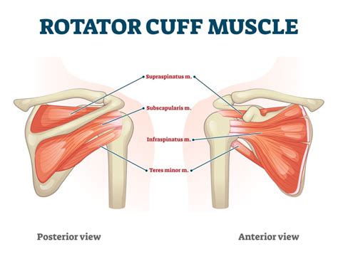 Rotator Cuff Tendonitis Motus Physical Therapy