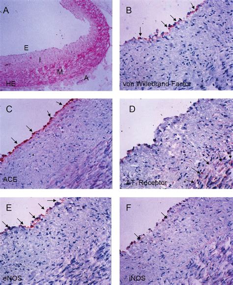 Cellular Co Localization Of Ace At1 Receptor Enos And Inos Expression Download Scientific