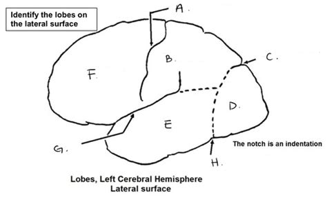 Neuroanatomy Lab Flashcards Quizlet