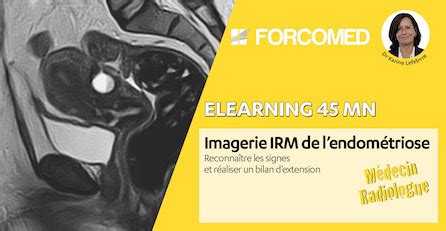 Formation à l imagerie IRM du pelvis féminin