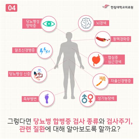 당뇨병 만성합병증 검사 안내