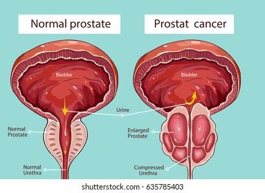 Anatomy Of Prostate And Bladder Anatomical Charts Posters