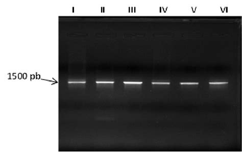 Pcr Gel Electrophoresis Showing S Rrna Gene Bands At Pb Of The