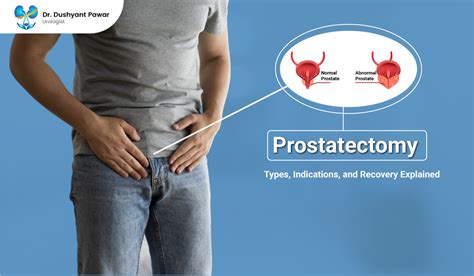 Prostatectomy: Types, Indications & Recovery | Dr. Dushyant Pawar