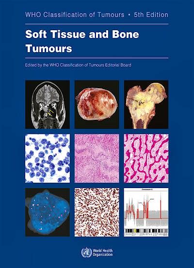 WHO Classification of Tumours: Soft Tissue and Bone Tumours (WHO Classification of Tumours, Vol ...