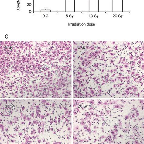 Gamma Ray Irradiation Induces The Apoptosis And Inhibits Proliferation