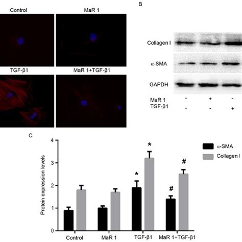 MaR 1 inhibits TGFβ1induced Smad and ERK phosphorylation in MRC5