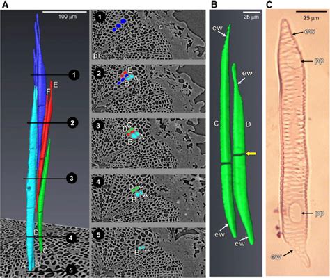 A Structure And Spatial Arrangement Of Xylem Vessel Elements In The