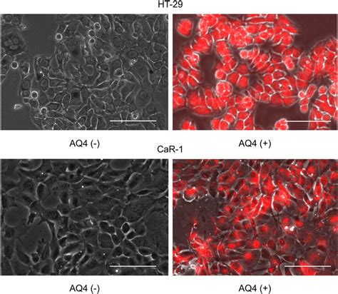Incorporation of AQ4 into HT-29 and CaR-1 cells. AQ4 (red) was detected ...