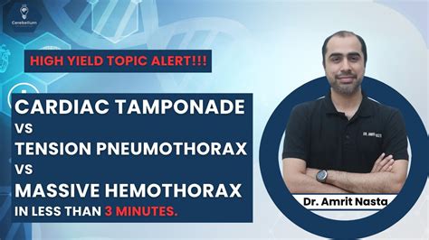 Cardiac Tamponade Vs Tension Pneumothorax Vs Massive Hemothorax