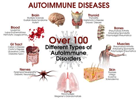 5 Steps to Heal Autoimmune Disease - DrJockers.com