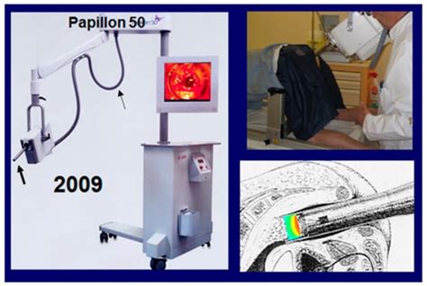 Cancers Free Full Text Targeted Radiotherapy Using Contact X Ray