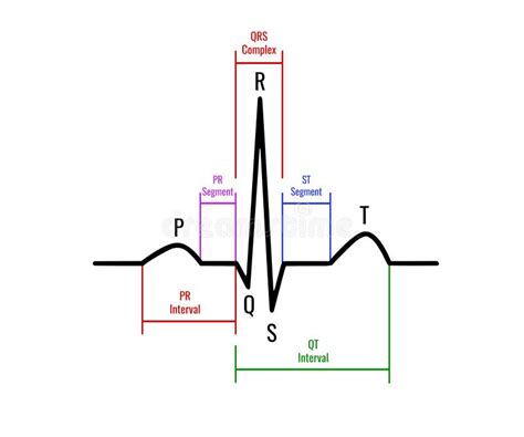 Illustration Of Ecg Interpretation Ecg Of A Healthy Person Stock Illustration Illustration Of