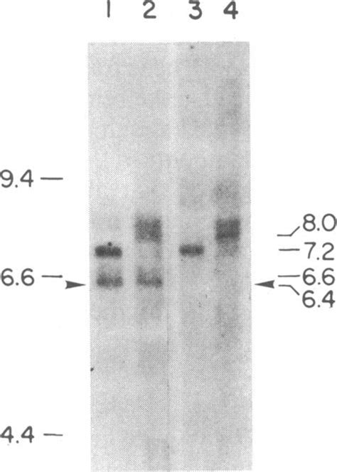 Blot Analysis Of Cytotactin Specific Mrnas Two Micrograms Of Polya