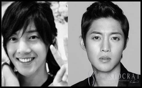 Lee Joon Ki Before After Plastic Surgery Hot Sex Picture