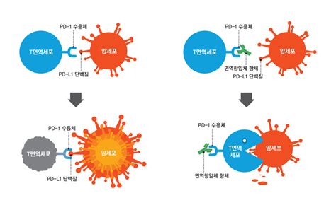 면역항암제 3세대 항암제로 주목부작용·고비용은 문제 의료·건강 사회 뉴스 한겨레