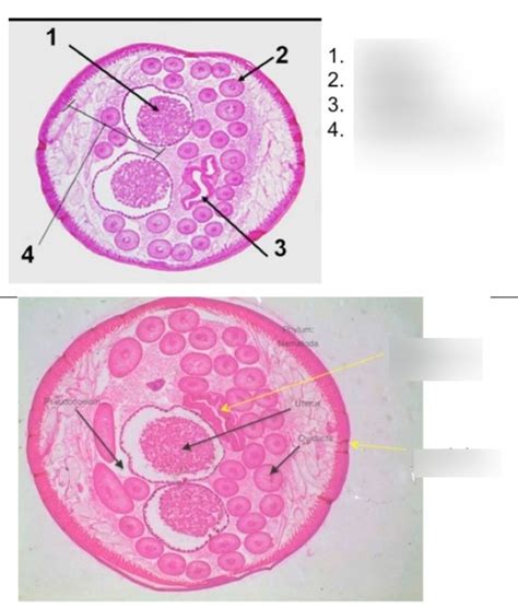 Ascaris Cross Section Diagram Quizlet