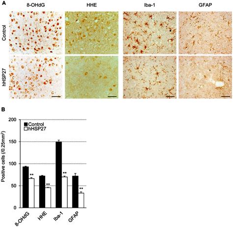 A Photomicrographs Of 8 Ohdg Hhe Iba 1 And Gfap Immunostaining