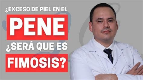 Exceso De Piel En El Pene Ser Que Es Fimosis Dr Luis Gutierrez