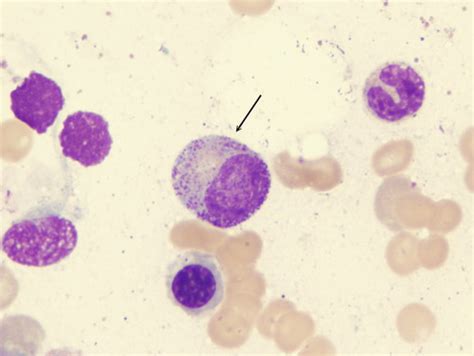 WBC Morphology Flashcards Quizlet