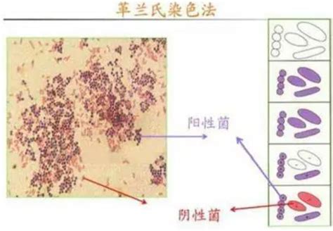 都21世纪了，你还在以雌雄辨别性别吗？微生物革兰氏细菌新浪新闻