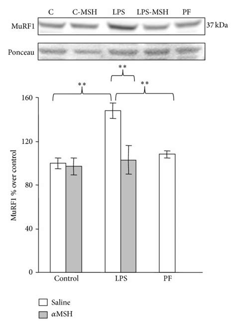 Atrogin Mrna A Murf Mrna B And Murf C In Gastrocnemius