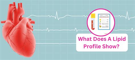 Understanding Lipid Profile Tests A Comprehensive Guide