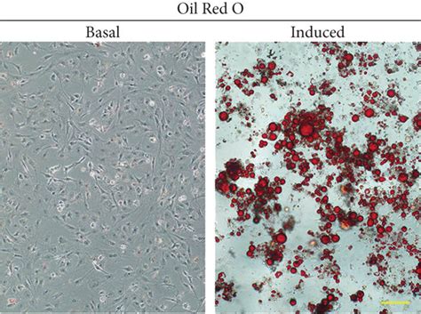 Adipogenic Differentiation Of Urine Derived Cells In Vitro A