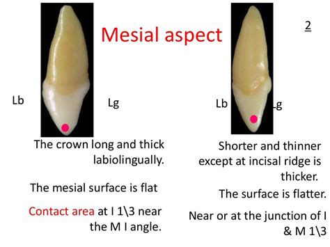 Upper Lateral Incisor