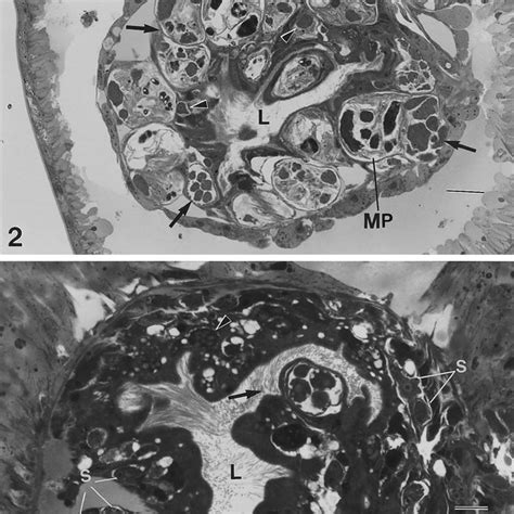 Cross Section Through Infected T Tubifex Showing Migration Of Download Scientific Diagram