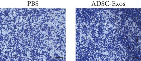 ADSC Exos Can Enhance DRG Neurite Outgrowth And Proliferation And