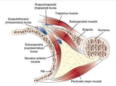 Scapulothoracic Bursitis