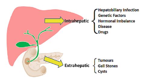 Cholestatic Liver Disease - Health Article | Drlogy