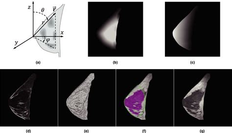 Fully Automatic Quantification Of Fibroglandular Tissue And Background