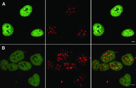 Differential Distribution Of Pericentric Heterochromatin In Mef And