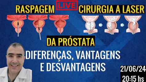 RASPAGEM DA PRÓSTATA x CIRURGIA A LASER DA PRÓSTATA diferenças