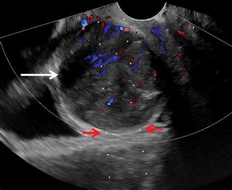 Us Guided Interventions To Diagnose And Treat Gynecologic And First