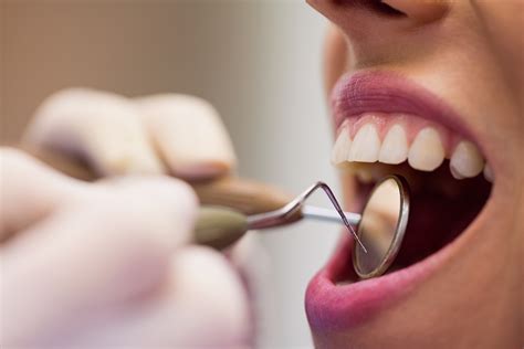 Odontolog A Preventiva Cl Nica Dental En Coria Del R O