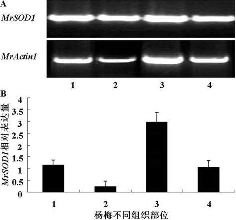 杨梅cuzn超氧化物歧化酶基因（mrsod1）cdna的克隆及表达分析 －挑战杯