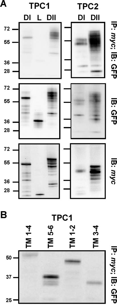 A Top Panels Western Blot Analysis Using An Anti Gfp Antibody Of