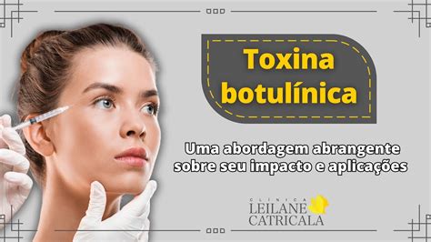 TOXINA BOTULÍNICA saiba tudo sobre o procedimento estético mais