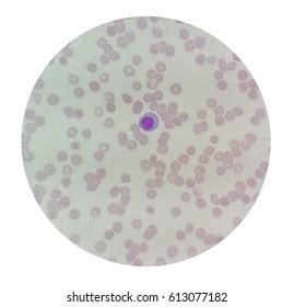 Blood Smear Slide Under Microscope Present Stock Photo