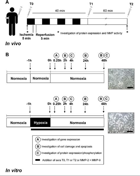 Figure 1 From Serum From Patients Undergoing Remote Ischemic