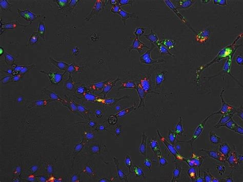 Invitrogen Low Density Lipoprotein From Human Plasma Phrodo Green