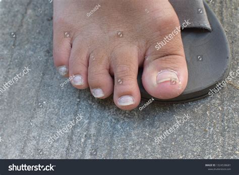 Mens Toenails Long Nails Stock Photo 1324538681 | Shutterstock