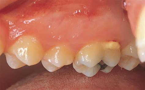 14 Periodontal Conditions Pocket Dentistry