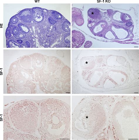 Hematoxylin Eosin Staining Of Ovarian Histology Of Adult Wt And