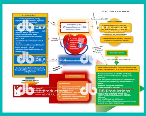 Stemi Concept Map Deanne Blach Db Productions Concept Map