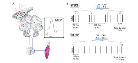 Single Pulse Transcranial Magnetic Stimulation Tms And Clinically